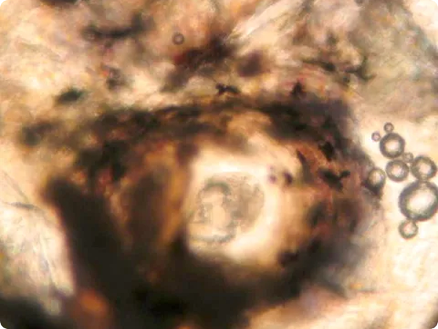Encysted Neascus in Skin of Fish