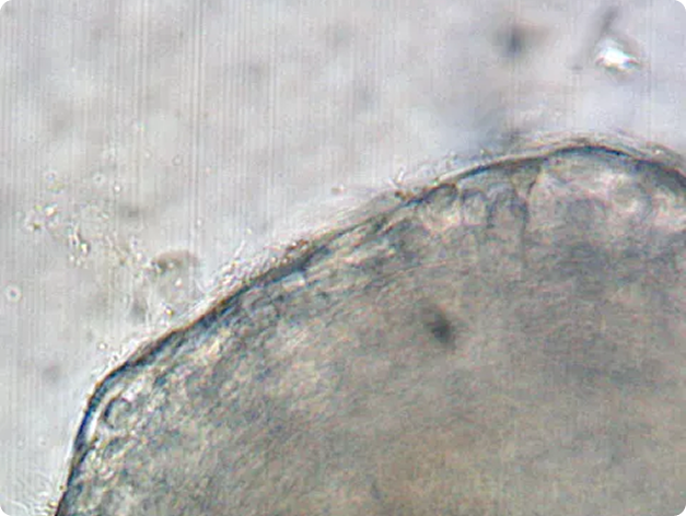 Filamentous Flavobacteria on Surface of Gill