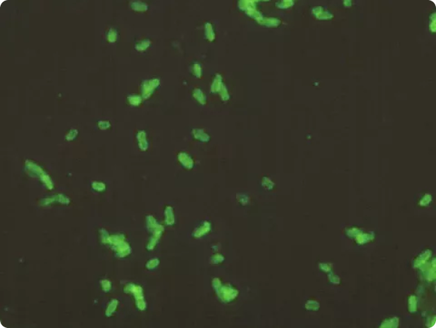 Fluorescence microscopy image of Renibacterium cells