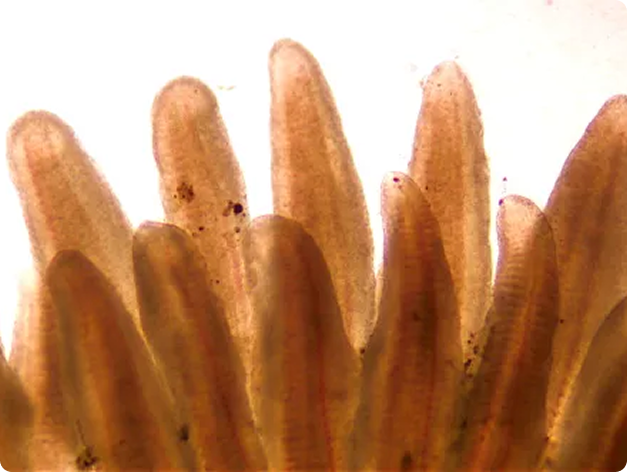 Gills Showing Fuzzy Margins Associated with Bacterial Kidney Disease (BKD)