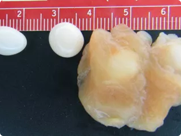 Henneguya salminicola Cysts Dissected from Fish Muscle