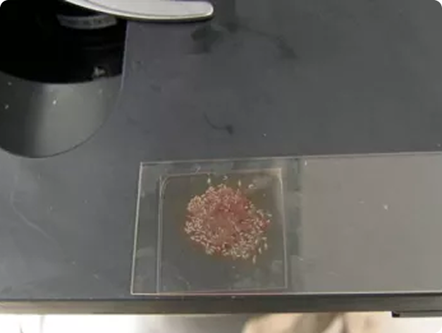 Hundreds of Posthodiplostomum from Crushed Liver