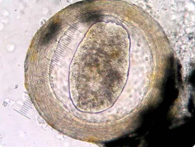 Immature Neascus