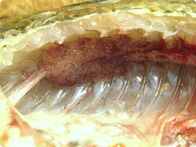Kidney Heavily Infected with White Grub