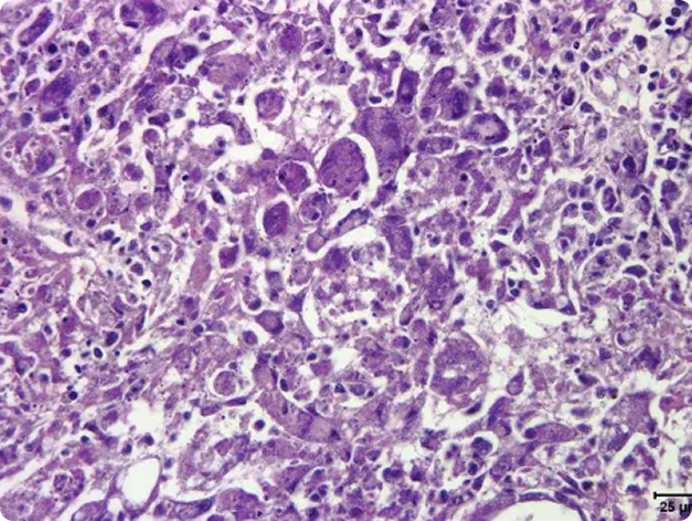 Kidney necrosis and inflammation caused by Renibacterium salmoninarum