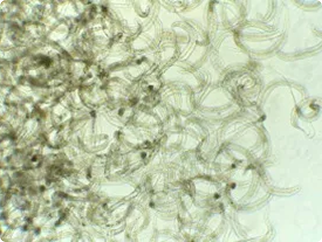 Mass of Adult Philonema Nematode Worms