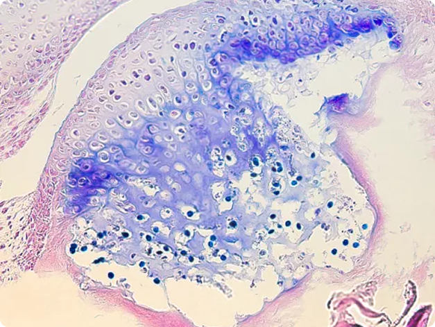 Myxosporean Infection in Head Cartilage of Rainbow Trou