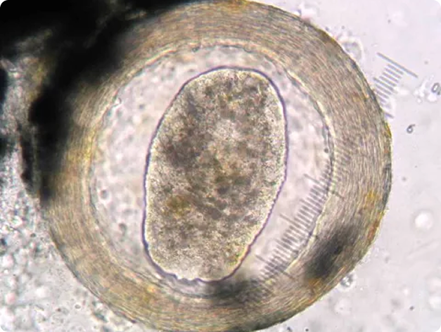 Neascus Metacercaria Exscised from the Skin of an Infected Fish