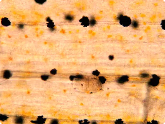 Neascus Metacercaria Not Yet Attached by the Dark, Melanin-Rich Pigment Cells