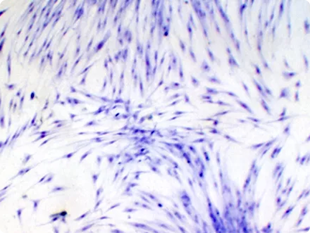 RTG-2 Cells Inoculated with IPNV
