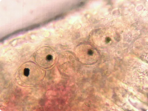 Sanguinicola Blood Flukes in Blood Vessels of Gills