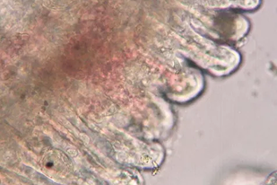Fish disease close-up