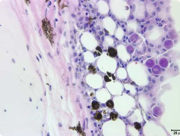 White Sturgeon Tissue Infected with Virus